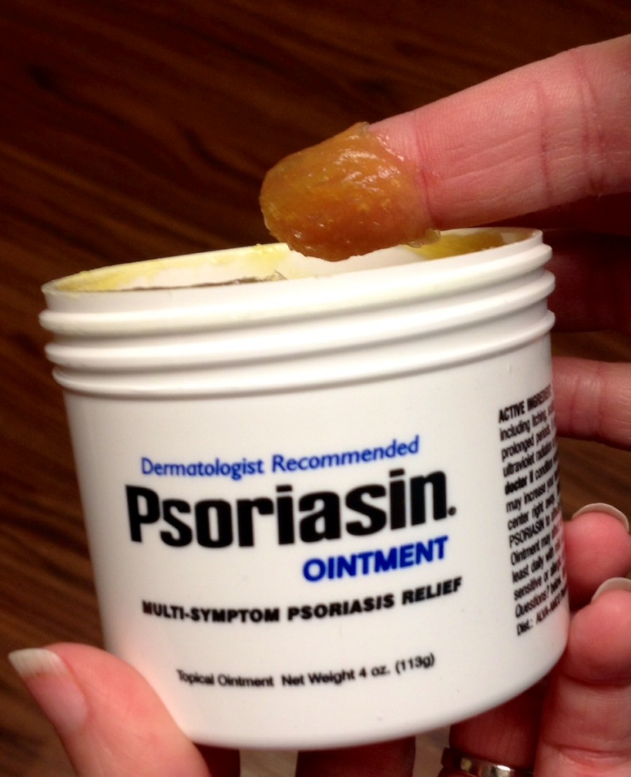 Men & Women Stylish Fashion Tips to Cover Psoriasis